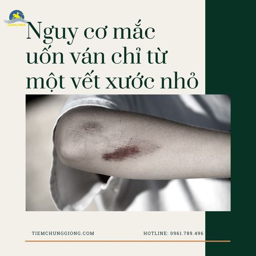 Nguy cơ mắc uốn ván chỉ từ 1 vết xước nhỏ