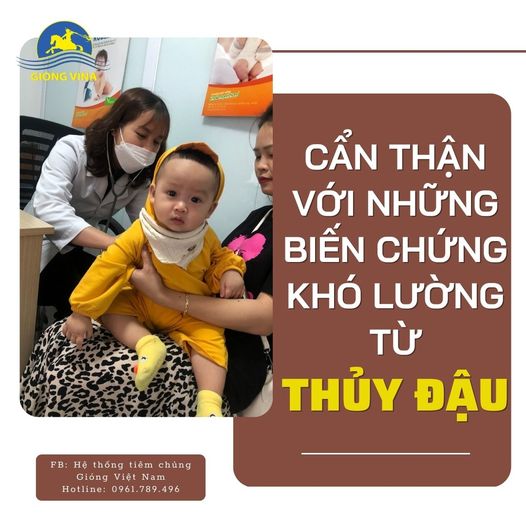 Cẩn thận với những biến chứng khó lường từ Thủy đậu