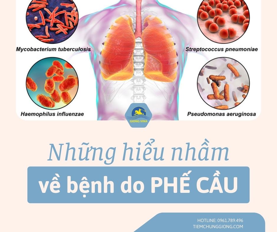 Những hiểu nhầm về bệnh do PHẾ Cầu