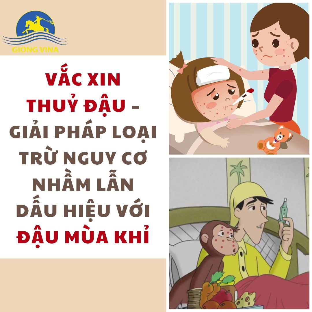 VẮC XIN THUỶ ĐẬU – GIẢI PHÁP LOẠI TRỪ NGUY CƠ NHẦM LẪN DẤU HIỆU VỚI ĐẬU MÙA KHỈ.