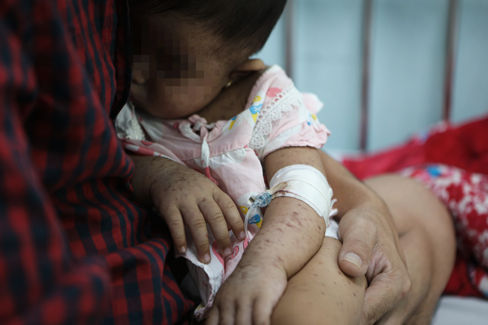 Những em bé đeo ống thở, mệt nhoài trong viện vì không tiêm vắc xin sởi