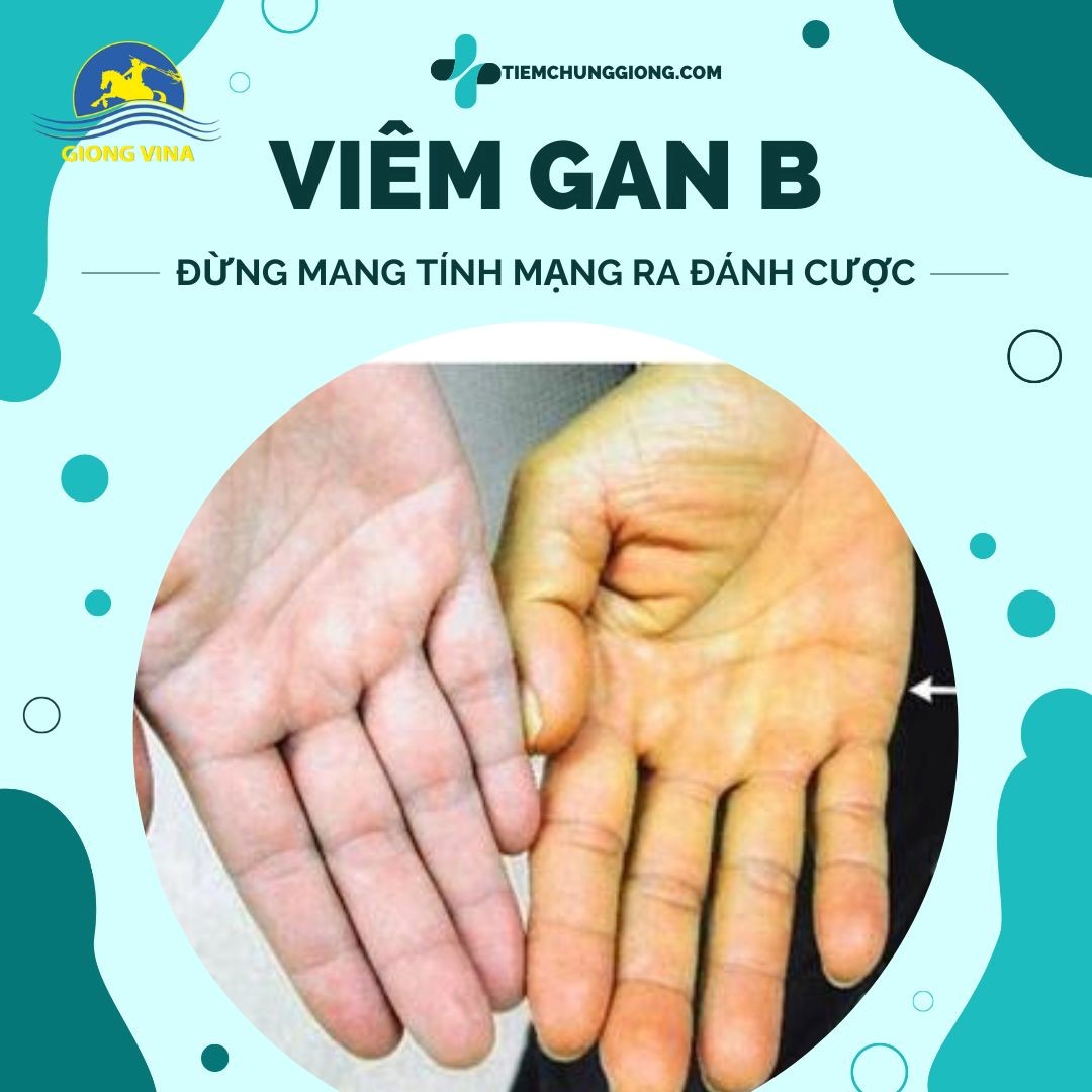 Viêm gan B – Đừng mang tính mạng ra đánh cược
