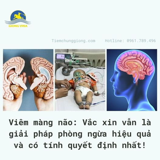 Viêm màng não: Vắc xin vẫn là giải pháp phòng ngừa hiệu quả và có tính quyết định nhất!