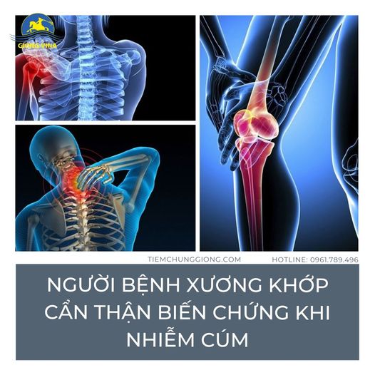 Người bệnh xương khớp cẩn thận biến chứng khi nhiễm cúm