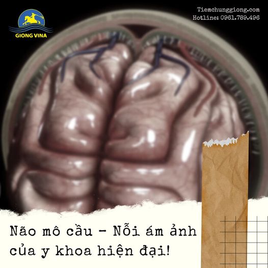 Não mô cầu - Nỗi ám ảnh của y khoa hiện đại!