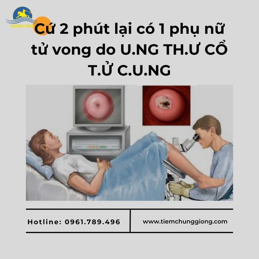 Cứ 2 phút lại có 1 phụ nữ tử vong do U.NG TH.Ư CỔ T.Ử C.U.NG