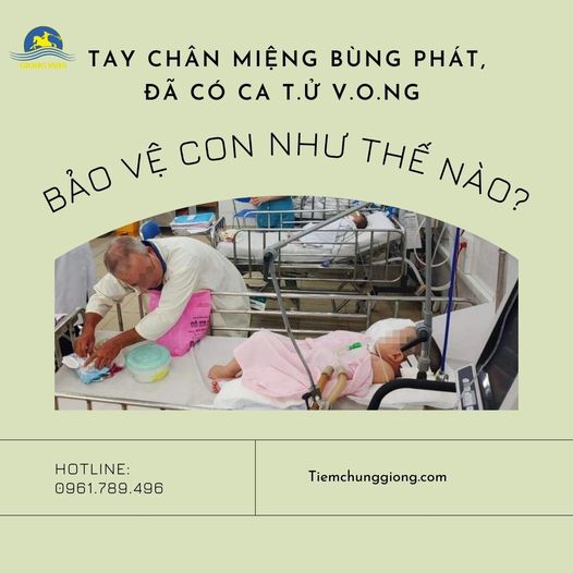 Tay chân miệng bùng phát, đã có ca t.ử v.o.ng – Bảo vệ con như thế nào