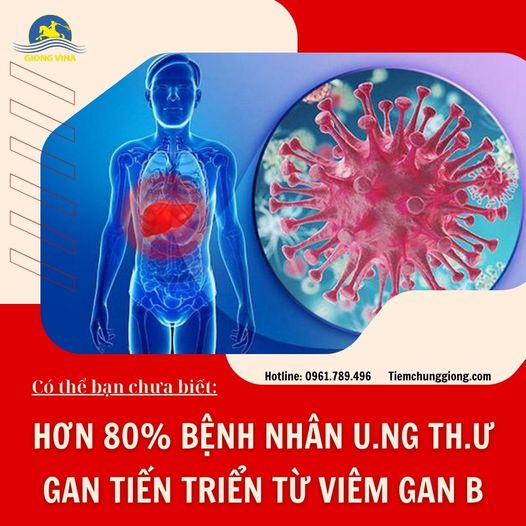Có thể bạn chưa biết: HƠN 80% BỆNH NHÂN U.NG TH.Ư GAN TIẾN TRIỂN TỪ VIÊM GAN B