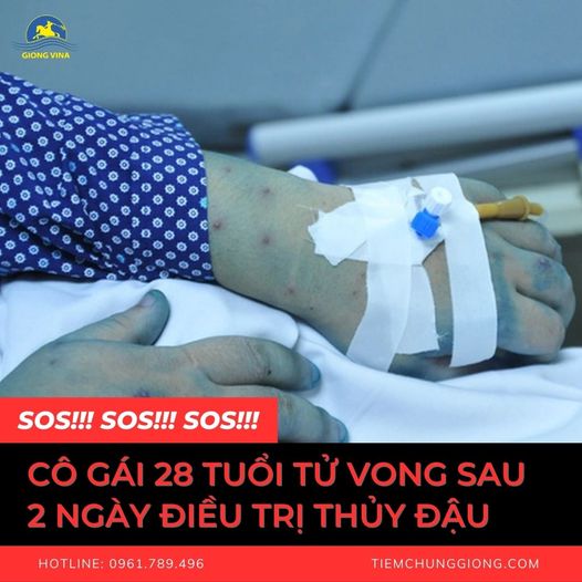 Cô gái 28 tuổi t.ử v.o.ng sau 2 ngày điều trị THỦY ĐẬU