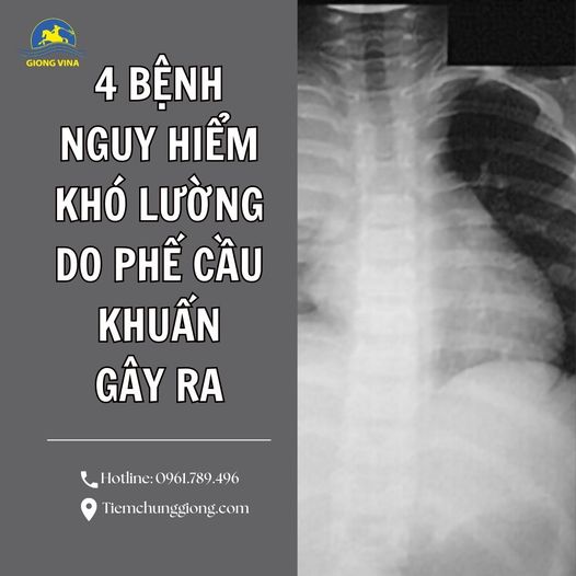 4 BỆNH NGUY HIỂM KHÓ LƯỜNG DO PHẾ CẦU KHUẨN GÂY RA!!!