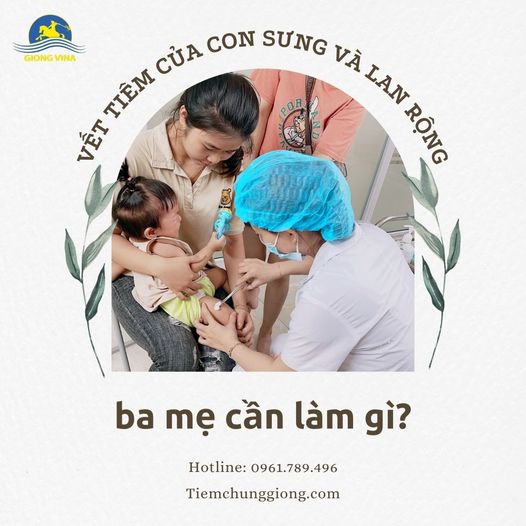 Vết tiêm của con sưng và lan rộng, ba mẹ cần làm gì?