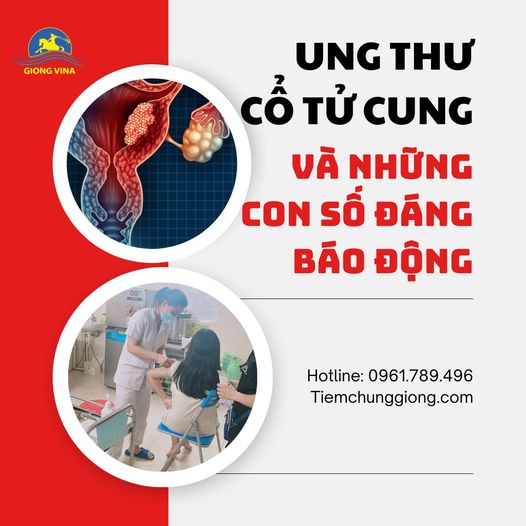 U.ng th.ư cổ tử cung và NHỮNG CON SỐ ĐÁNG BÁO ĐỘNG!