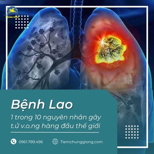 Bệnh Lao – 1 trong 10 nguyên nhân gây t.ử v.o.ng hàng đầu thế giới 