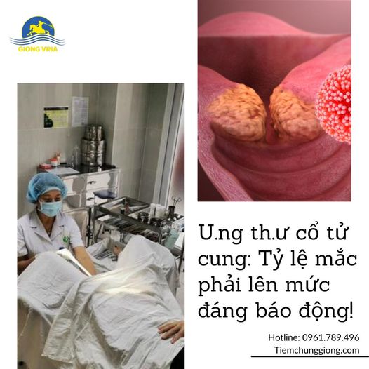U.ng th.ư cổ tử cung: Tỷ lệ mắc phải lên mức đáng báo động!