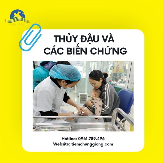 THỦY ĐẬU VÀ CÁC BIẾN CHỨNG