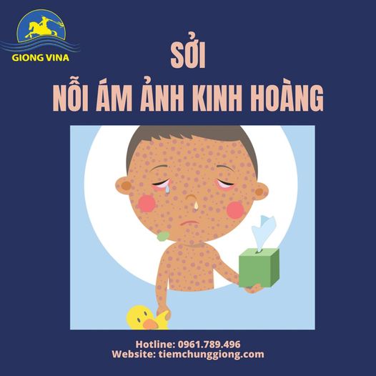 SỞI – NỖI ÁM ẢNH KINH HOÀNG