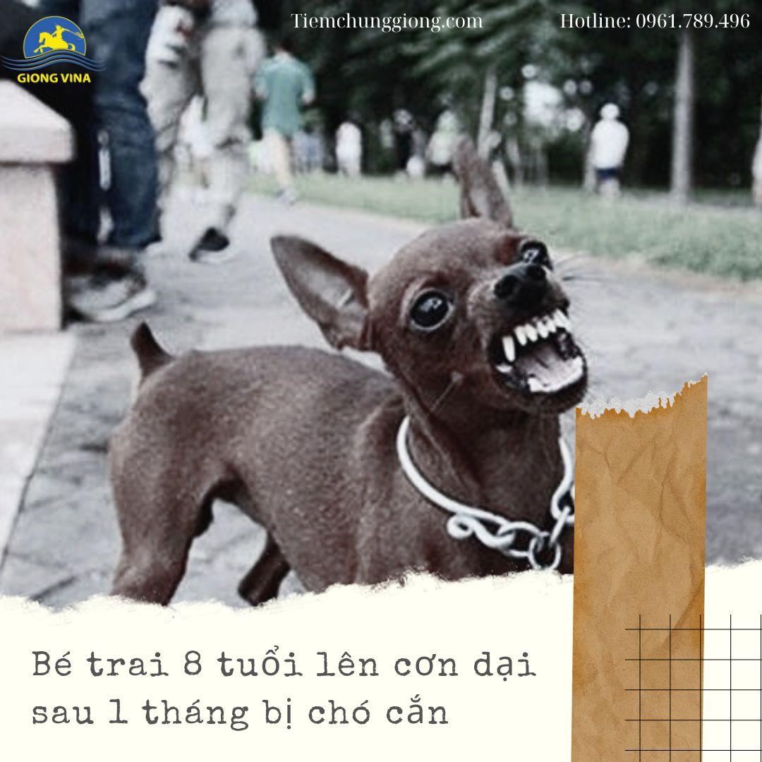 Bé trai 8 tuổi lên cơn dại sau 1 tháng bị chó cắn