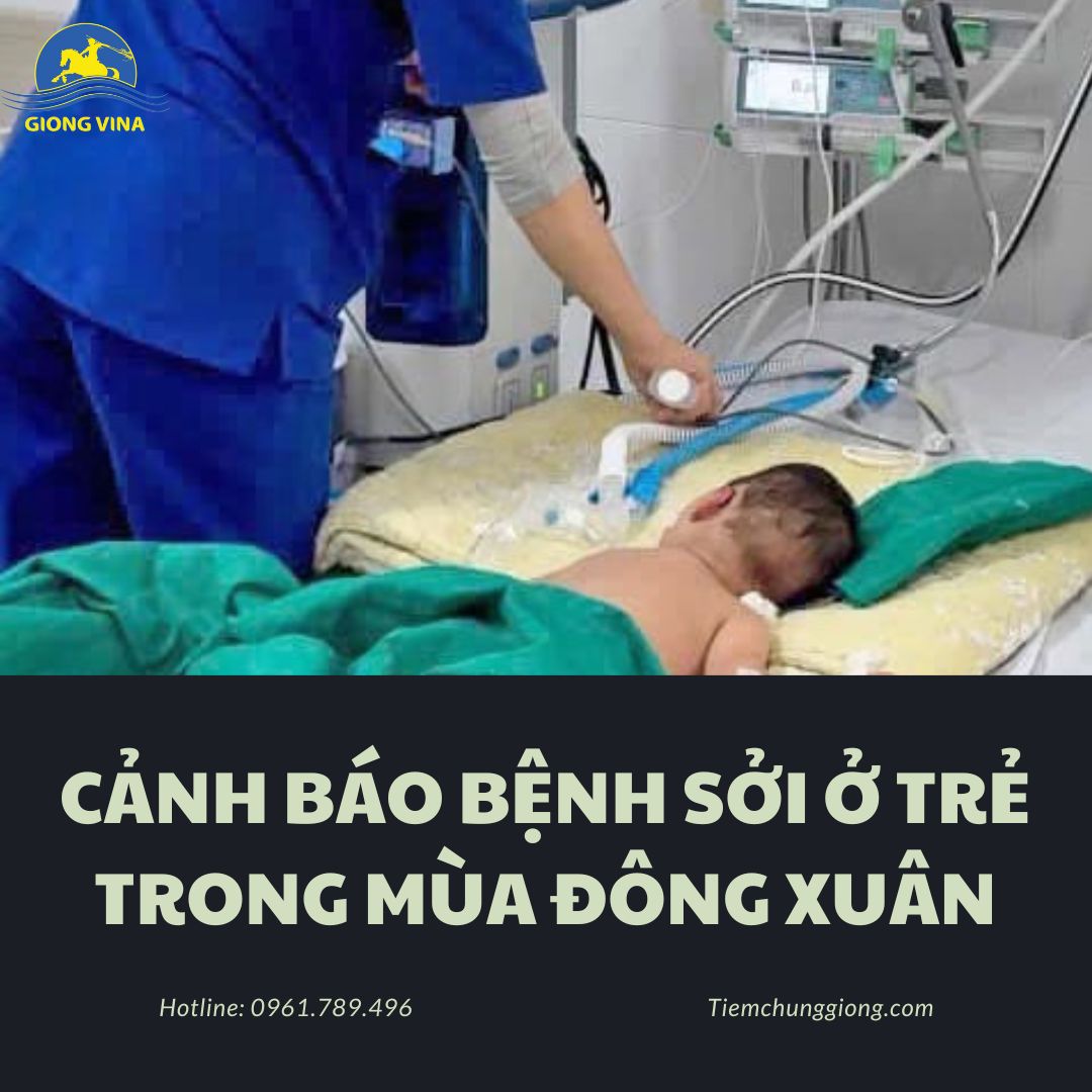 Cảnh báo bệnh sởi ở trẻ trong mùa đông xuân