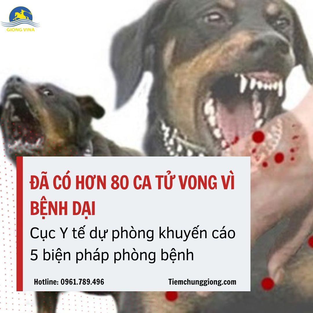 Đã có hơn 80 ca tử vong vì bệnh dại, Cục Y tế dự phòng khuyến cáo 5 biện pháp phòng bệnh