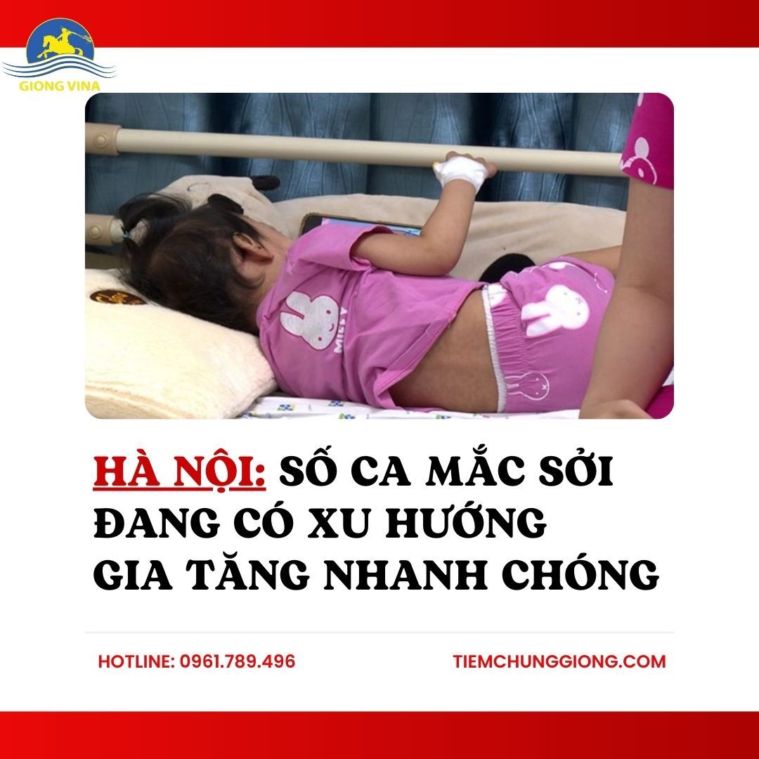 Hà Nội: Số ca mắc sởi đang có xu hướng gia tăng nhanh chóng