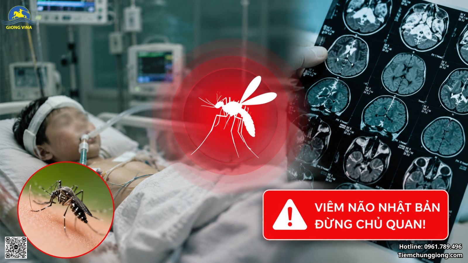 CẢNH BÁO: VIÊM NÃO NHẬT BẢN ĐÃ XUẤT HIỆN TRỞ LẠI – ĐỪNG CHỦ QUAN!