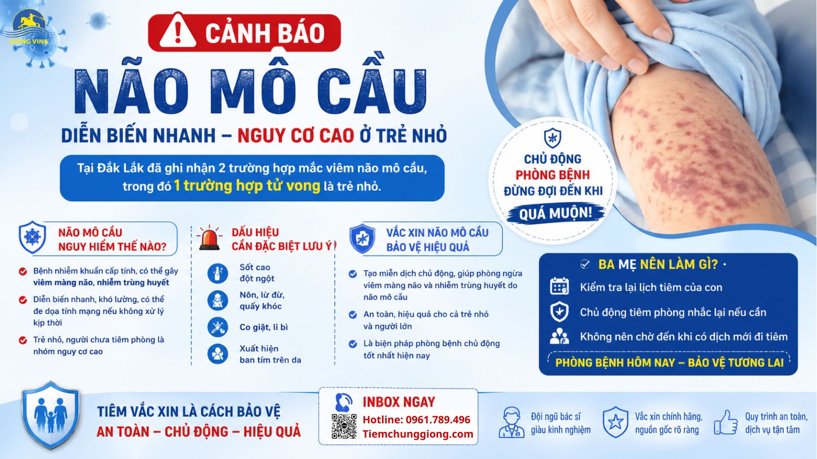 Đã ghi nhận ca tử vong do não mô cầu ở trẻ nhỏ – Ba mẹ đã kiểm tra lịch tiêm cho con chưa?