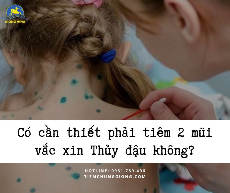 Có cần thiết phải tiêm 2 mũi vắc xin Thủy đậu không?