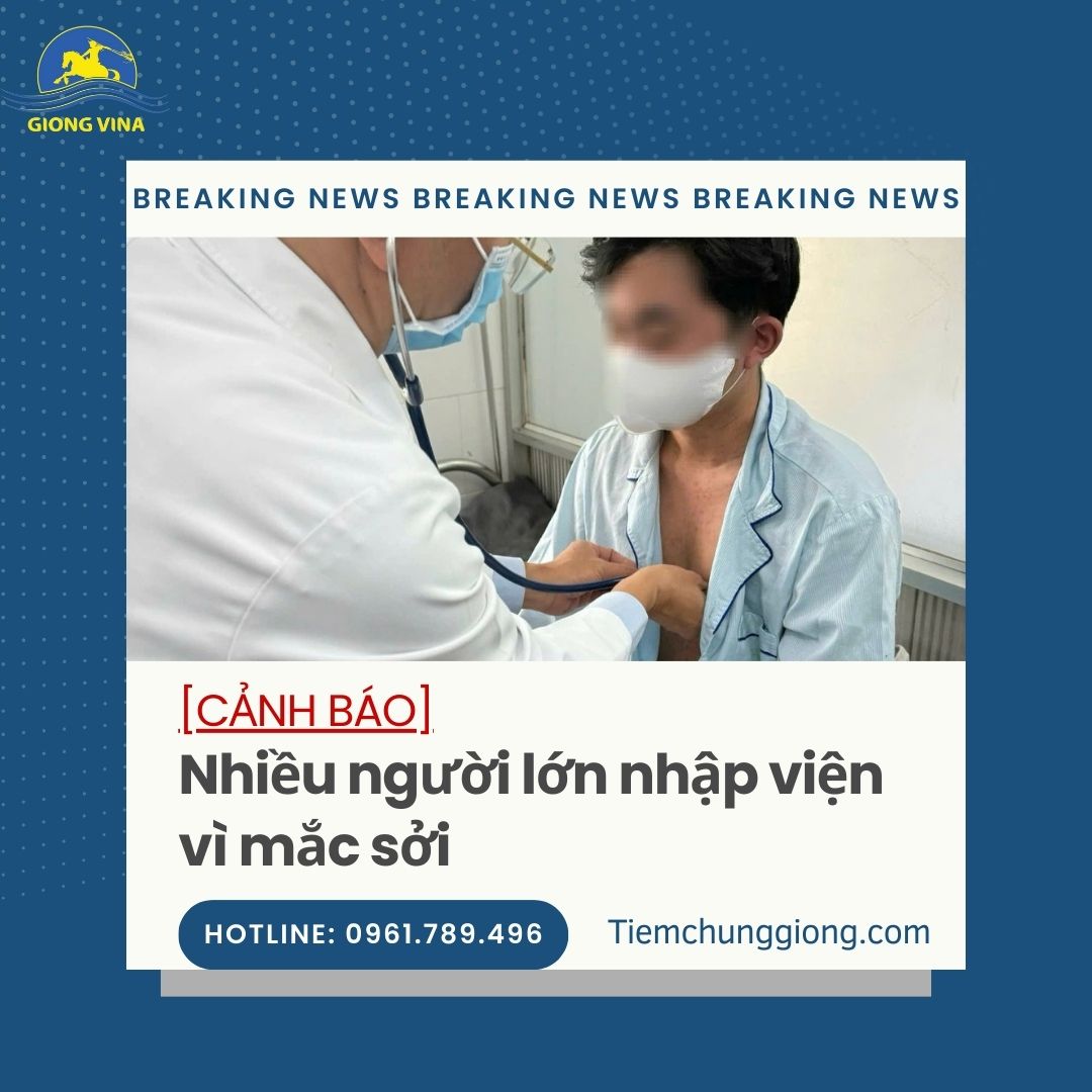 [CẢNH BÁO] Nhiều người lớn nhập viện vì mắc sởi