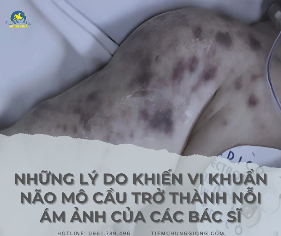  NHỮNG LÝ DO KHIẾN VI KHUẨN NÃO MÔ CẦU TRỞ THÀNH NỖI ÁM ẢNH CỦA CÁC BÁC SĨ