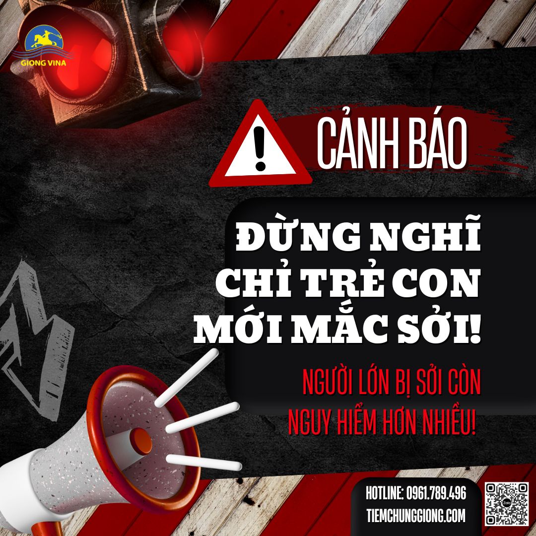ĐỪNG NGHĨ CHỈ TRẺ CON MỚI MẮC SỞI!