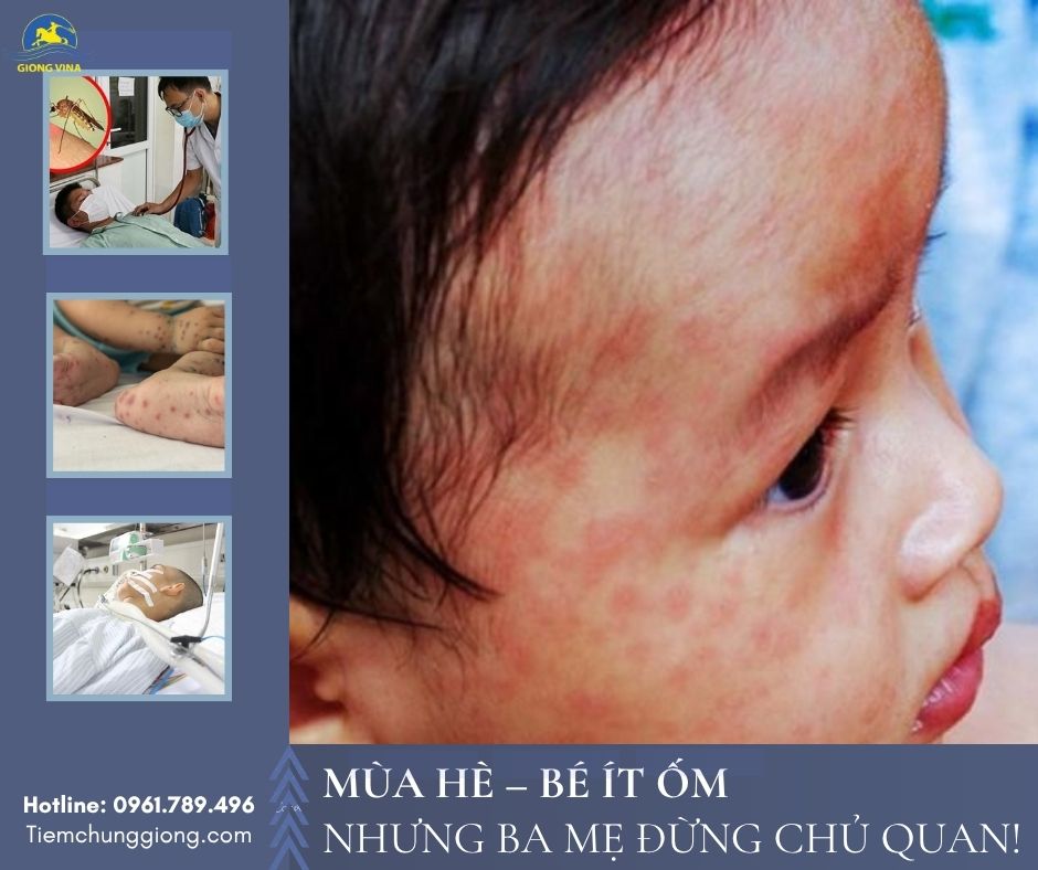 Mùa hè – Bé ít ốm, nhưng ba mẹ đừng chủ quan!