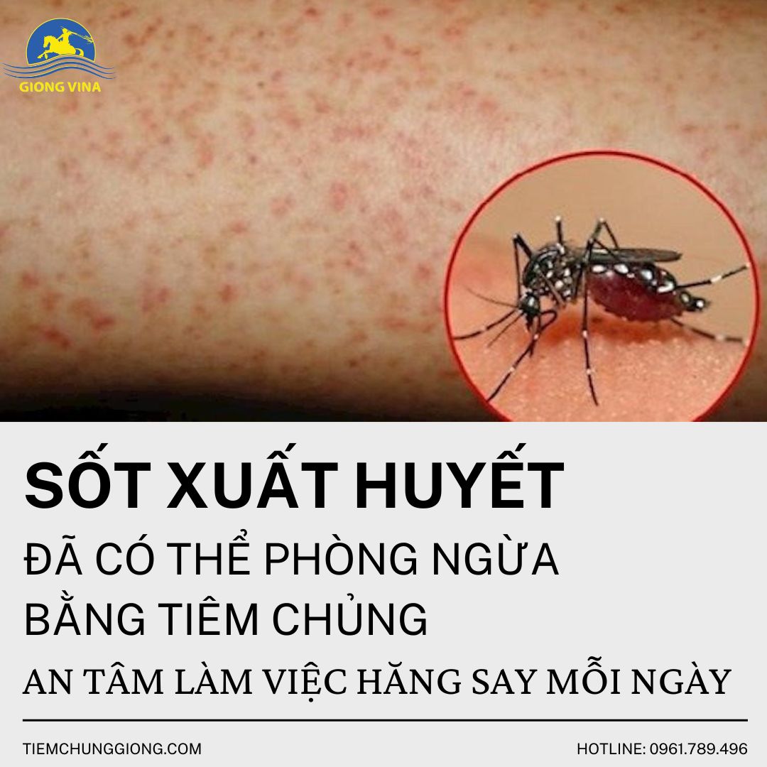 SỐT XUẤT HUYẾT ĐÃ CÓ THỂ PHÒNG NGỪA BẰNG TIÊM CHỦNG, AN TÂM LÀM VIỆC HĂNG SAY MỖI NGÀY 