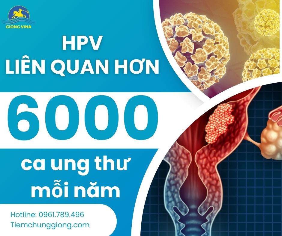 HPV liên quan hơn 6.000 ca ung thư mỗi năm