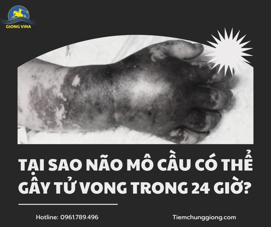 Tại sao não mô cầu có thể gây tử vong chỉ trong 24 giờ?