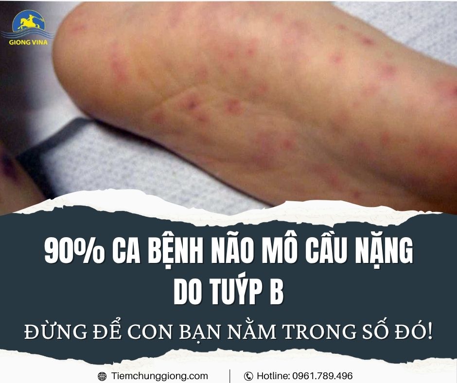 90% ca bệnh não mô cầu nặng do tuýp B – Đừng để con bạn nằm trong số đó!
