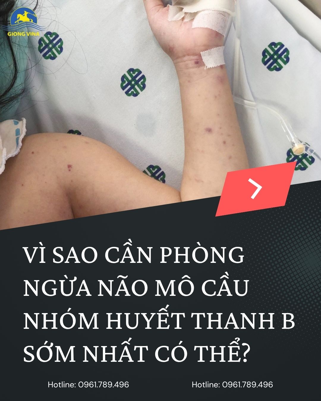 VÌ SAO CẦN PHÒNG NGỪA NÃO MÔ CẦU NHÓM HUYẾT THANH B SỚM NHẤT CÓ THỂ?