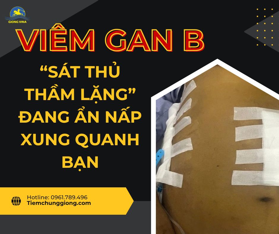 VIÊM GAN B – “SÁT THỦ THẦM LẶNG” ĐANG ẨN NẤP XUNG QUANH BẠN