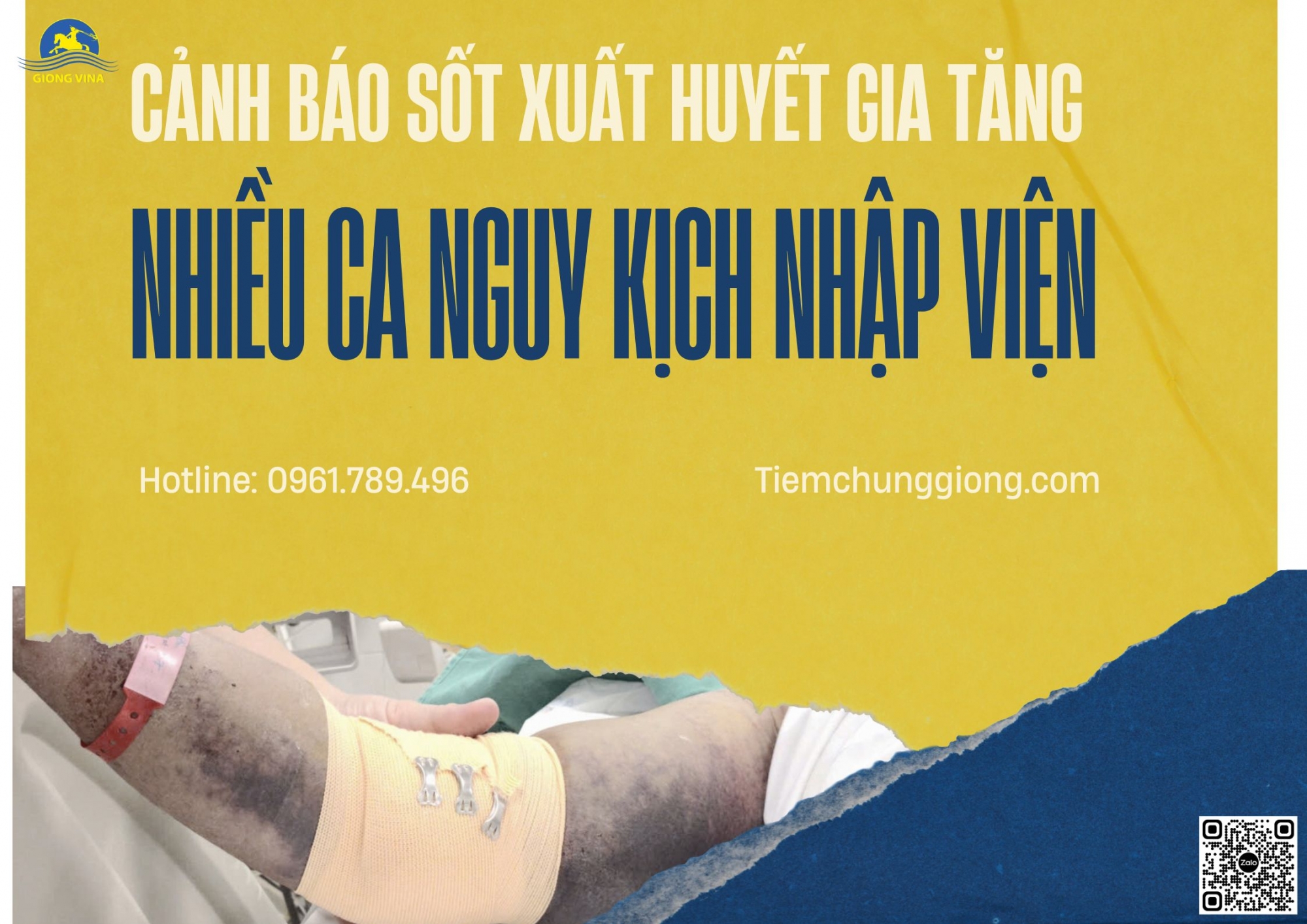 CẢNH BÁO SỐT XUẤT HUYẾT GIA TĂNG – NHIỀU CA NGUY KỊCH NHẬP VIỆN 