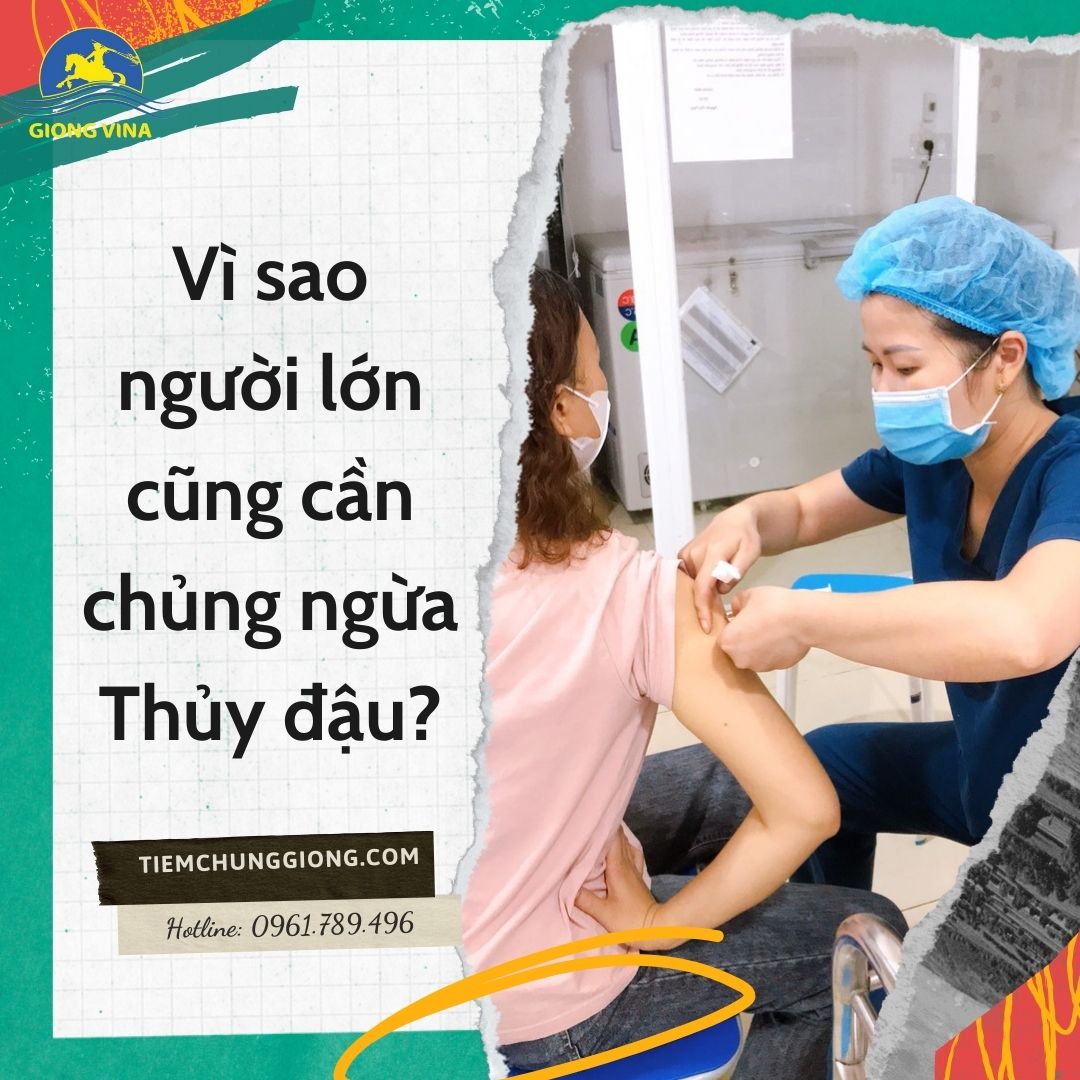 Vì sao người lớn cũng cần chủng ngừa Thủy đậu?