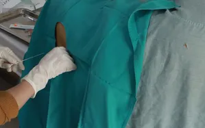 Viêm màng não mủ - Căn bệnh nguy hiểm dễ gây tử vong nếu chậm trễ