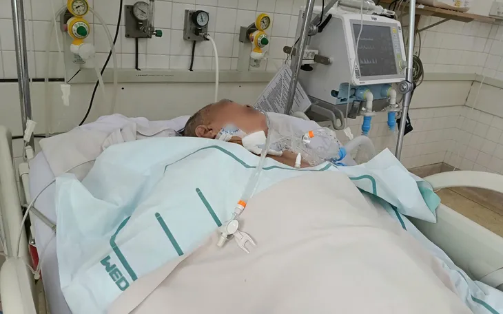 Biến chứng zona tấn công não: Hai bệnh nhân nguy kịch